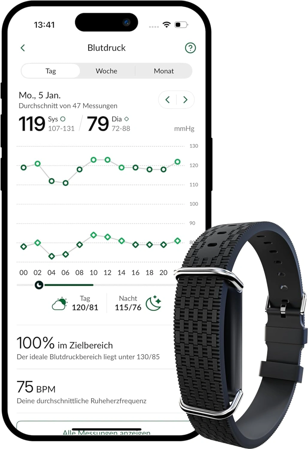 Hilo Band: Armband vor App-Ansicht mit Blutdruckverlauf