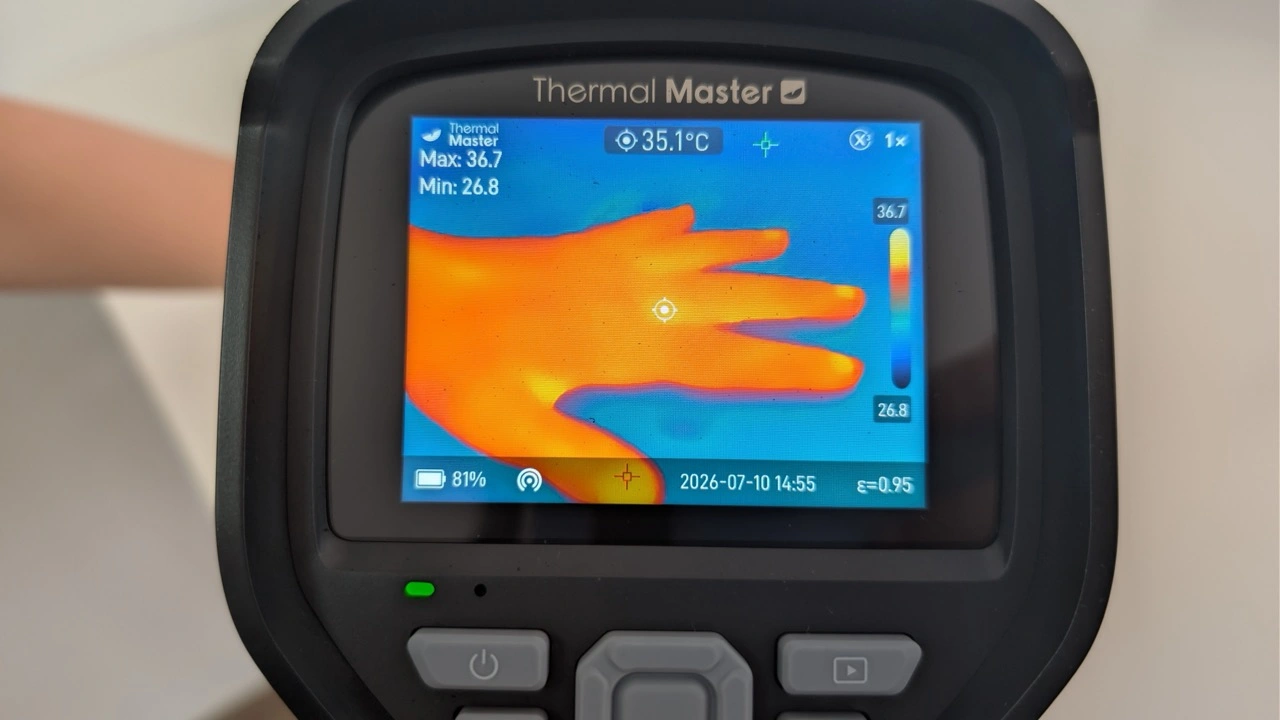 Thermal Master Thor002: Wärmebild einer Hand auf dem Display