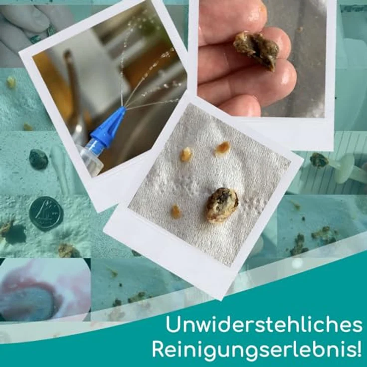 Medi Grade Ohrenreiniger und Ohr Wachs-Entferner Spritzen Set mit 3 x Sanften Quad-Stream Ohrenschmalz Entferner | Ohrenschmalzentferner Set für die Ohr Reinigung | Ohrenschmalz Entfernen – Bild 5