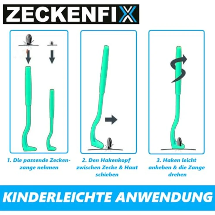 MPETS Zeckenzange Hunde Katze Zeckenpinzette Zeckenentferner Zeckenhaken Set - Preisvergleich – Bild 6