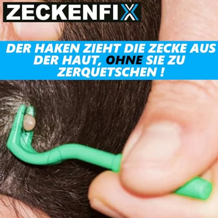 MPETS Zeckenzange Hunde Katze Zeckenpinzette Zeckenentferner Zeckenhaken Set - Preisvergleich – Bild 3