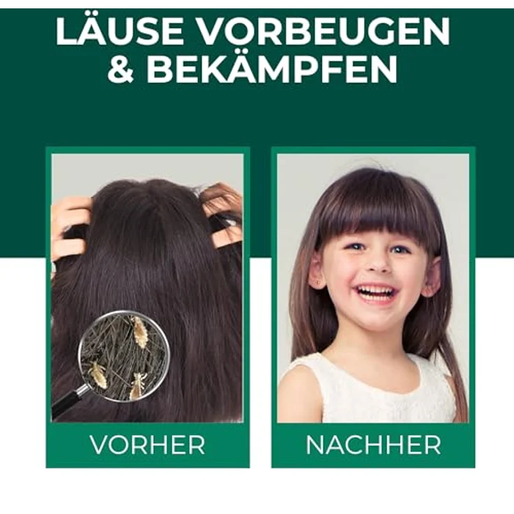 Silberkraft Kopfläusespray, Effektiver Läuseschutz für Kinder, 100 ml, mit Geraniol, dermatologisch getestet – Bild 2