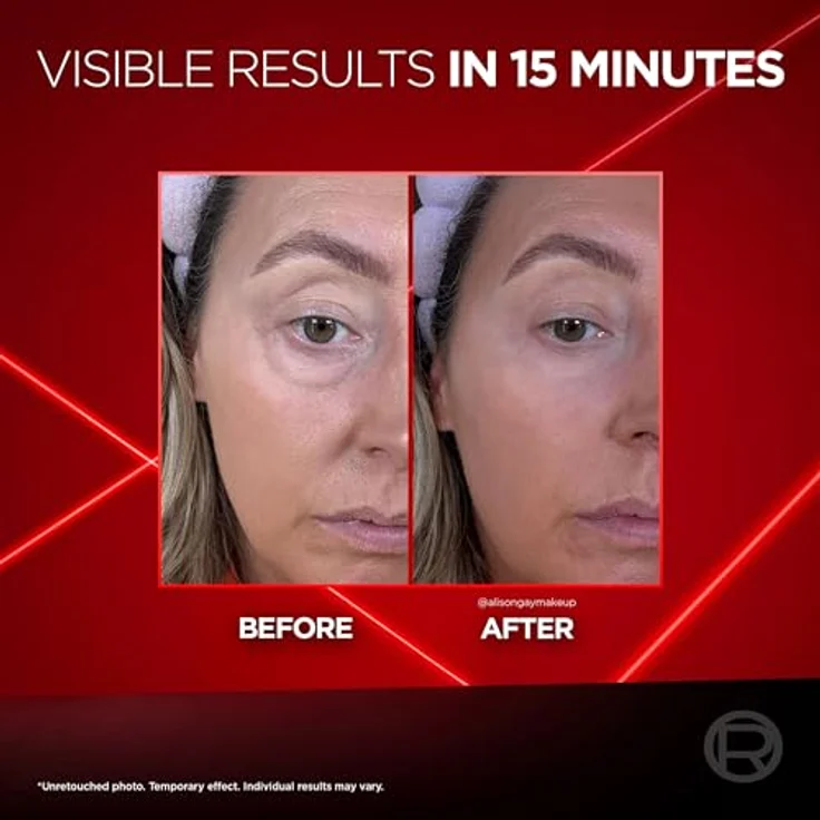 L'Oréal Paris Revitalift Laser Eye Bag Instant Eraser, Augenpflege Crème, 15 ml, Tag + Nacht, für reduzierte Schwellungen und Dunkle Ringe – Bild 3