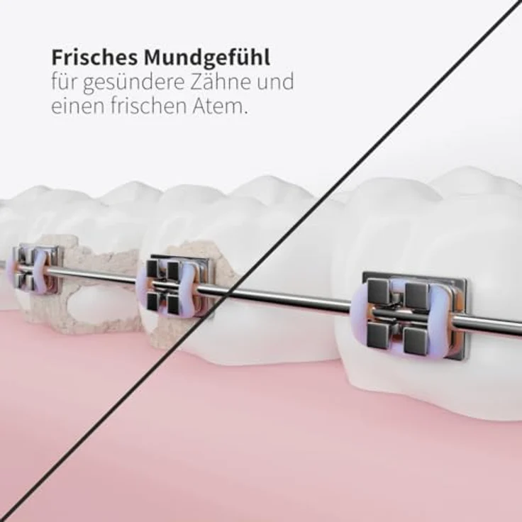 Zahnheld® Ersatzdüsen Basic für Munddusche Aquadent, 3 Stück, effektive Reinigung, schwarz – Bild 3