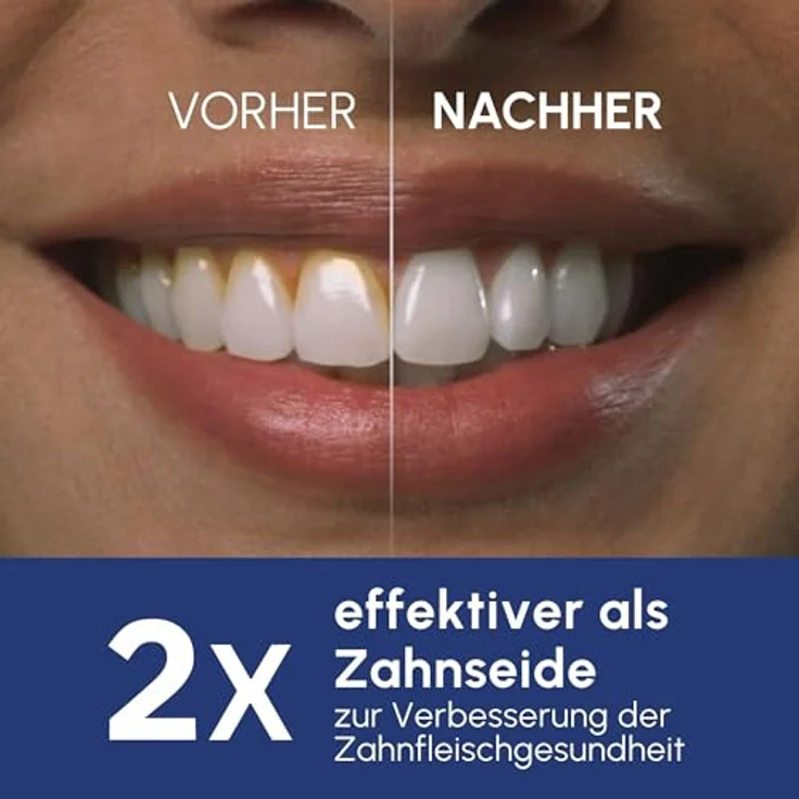 Waterpik Pulse, kabellose Munddusche mit 99,9% Plaque-Entfernung, 2 Intensitätsmodi, 45 Sekunden Wassertank, 2 Aufsätze, weiß – Bild 3