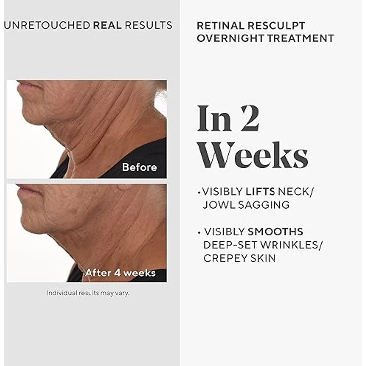 Murad Retinal ReSculpt Overnight Treatment - Resurgence Anti-Ageing Serum gegen Linien und Falten - 30ml, verkapselte Vitamin A Hautpflege für Glättung, Straffung und Lifting von Gesicht und Hals – Bild 3