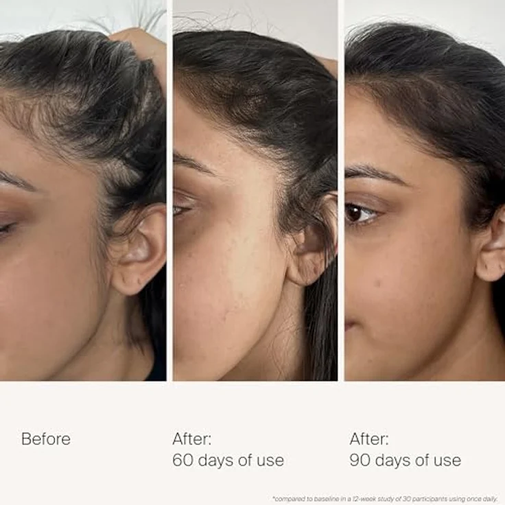 Living Proof Scalp Care Density Serum (50ml) – Serum für gesunde Kopfhaut & Haardichte – Gegen Haarausfall & graues Haar – Schnell einziehend & nicht ausspülbar – Bild 2