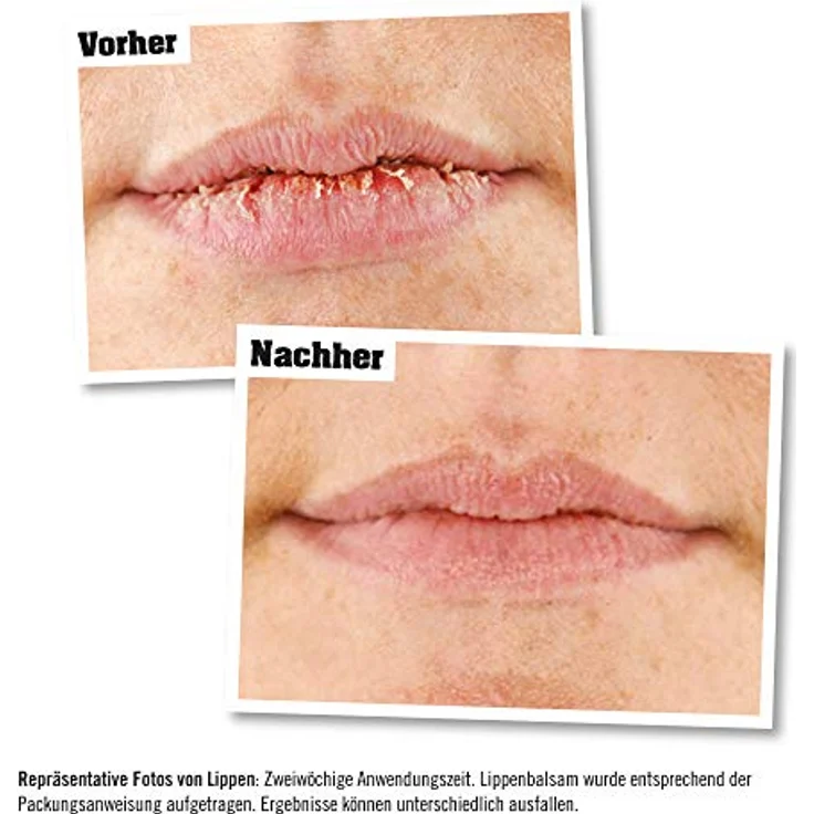 O'Keeffe's Lip Repair Unparfümierter Lippenbalsam 4.2g – Bild 5