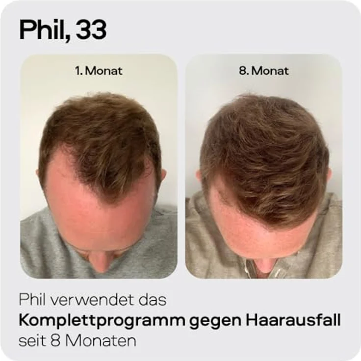 Sons Minoxidil 5% Lösung mit Derma Roller für Männer, fördert Haarwachstum und -dichte, 60 ml – Bild 4