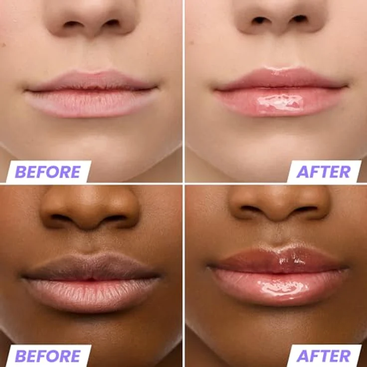 Wonderskin Lip Rehab Serum Oil – Getöntes Lippenöl, feuchtigkeitsspendend und nicht klebrig, Korallrosa-Tönung für trockene Lippen (Lover) – Bild 3