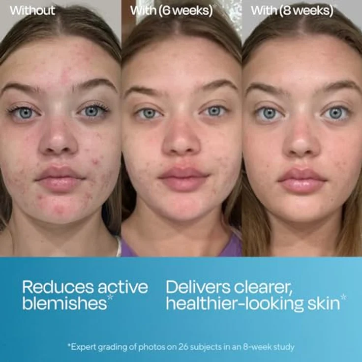 Murad Blemish Control, Gesichtsserum zur Unreinheitenbekämpfung, 30 ml – Bild 2