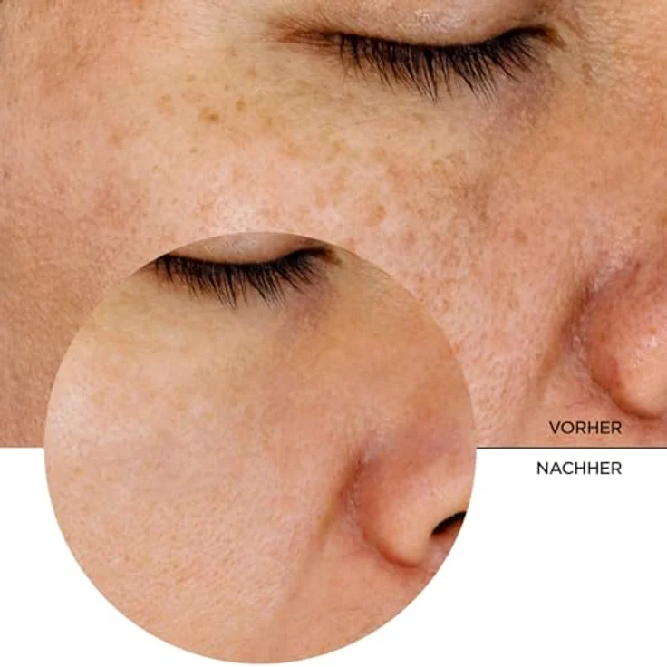 Revox B77 JUST Glykolsäure 7%, Gesichtstonikum für Damen, alkoholfrei, 250 ml – Bild 7
