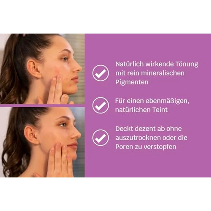SIRIDERMA Getönte Tagescreme | heller Hautton I Natürliche Tönung für das Gesicht | Bei empfindlicher Haut | Auch bei Rosacea (ohne Parfum, 15 ml) – Bild 3