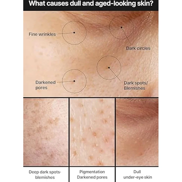 celimax Pore+Dark Spot Brightening Cream | 35 ml mit Niacinamid, Tranexamsäure, Porenminimizer, feuchtigkeitsspendend, für empfindliche Haut, hypoallergen – Bild 4