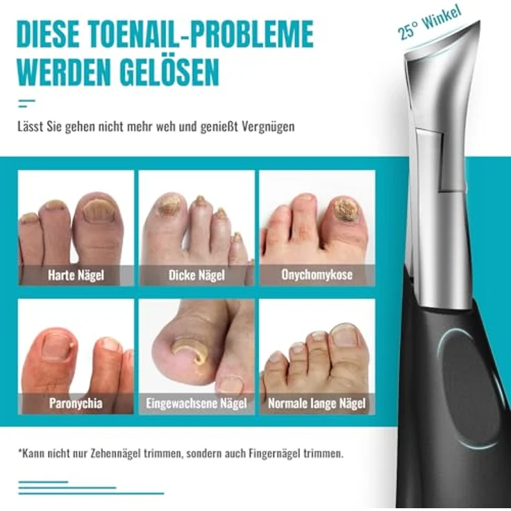 RONAVO Profi Zehennagelknipser, Edelstahl, extra breitere Schneidöffnung, langer rutschfester Griff, ideal für dicke und eingewachsene Nägel – Bild 2