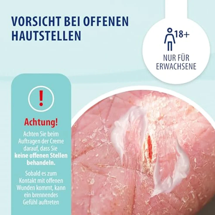 Evolsin Behrend Schuppenflechte & Neurodermitis Cr.intens. 50 ml, intensiv feuchtigkeitsspendende Gesichtspflege ohne Kortison und Parabene – Bild 4