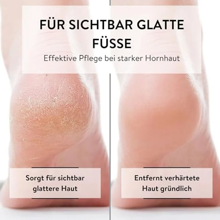 PARSA BEAUTY Hornhautraspel für glatte Füße, professioneller Edelstahl Hornhautentferner mit ergonomischem Design für sanfte Fußpflege – Bild 3