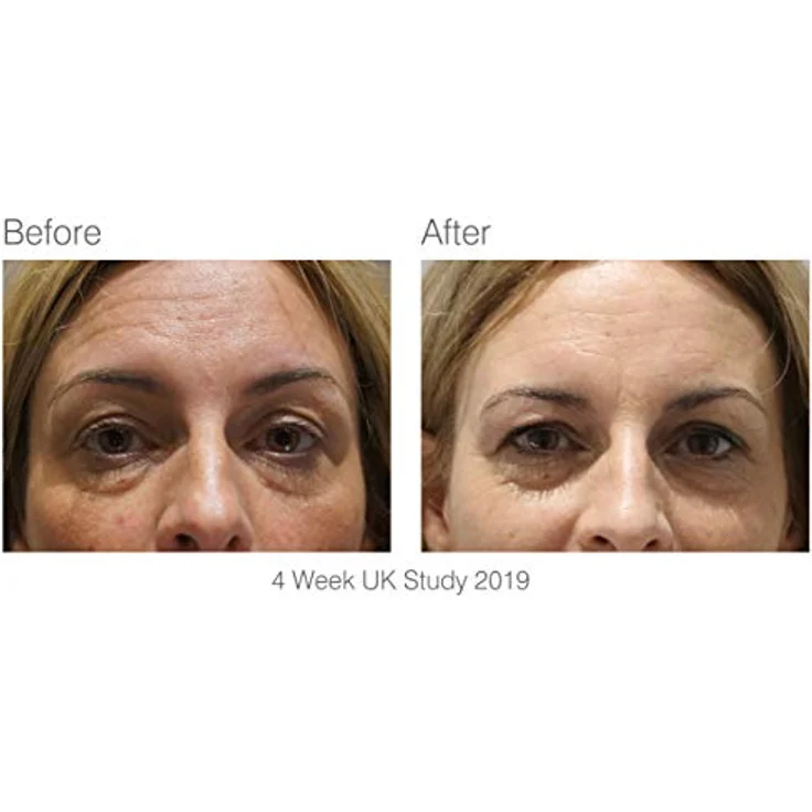 RIO Facelite Evolution, LED-Gesichtsmasken-Massagegerät zur Verbesserung der Hautbeschaffenheit und Festigung der Gesichts-konturen, 1 St. – Bild 7