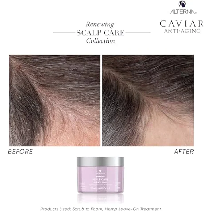 Alterna Renewing Scalp Care Scrub-to-Foam 177 ml, Kopfhaut-Peeling – Bild 5