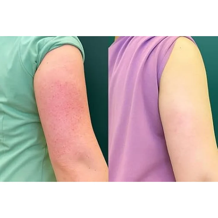 Australian Bodycare Bodylotion gegen Reibeisenhaut, glättet Keratosis Pilaris mit Salicylsäure, Niacinamid und Zink PCA, parfumfrei – Bild 2