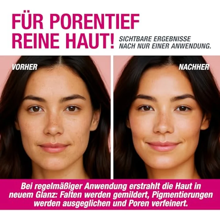 Svenja Walberg VAMPIRE FACIAL PEEL® Fruchtsäurepeeling 16% AHA + 5% TXA, vegan, pH 3.0, sofortige Glow-Effekte, gegen Pigmentflecken, ready to use – Bild 3