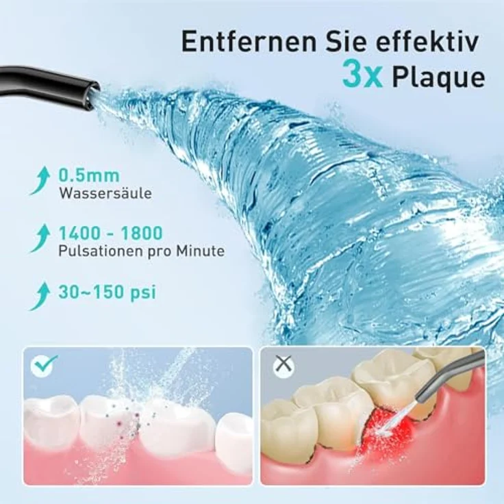 COSLUS Kabellose Munddusche, Elektrischer Zahnreiniger mit 4 Modi, 300ml Wassertank, 30 Tage Akkulaufzeit, IPX7 Wasserdicht, 4 Multifunktionsdüsen – Bild 3