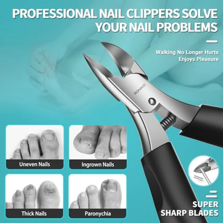 RONAVO Profi Fußnagel Nagelknipser Set, superscharfe Edelstahl Nagelzange für dicke und eingewachsene Fußnägel, ergonomischer Griff, inklusive Zubehör und Metall Geschenkbox – Bild 3