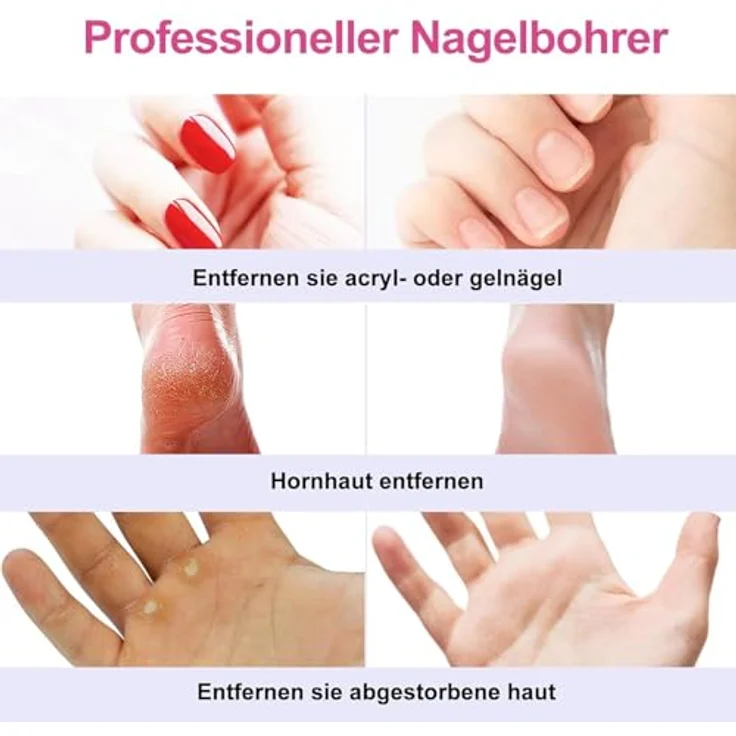 COSLUS C20 Kabellos Elektrischer Nagelfräser, Professionelles 11 in 1 Set, Wiederaufladbar, Einstellbare Geschwindigkeit, Geringe Geräuschentwicklung – Bild 4