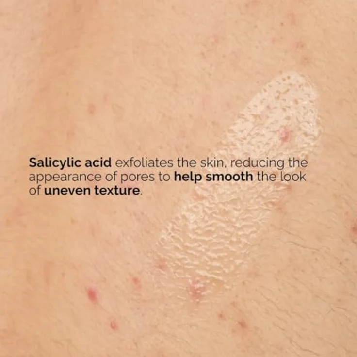 The Ordinary Salicylsäure 0,5% Body Serum, Ultra-leichtes und schnell absorbierendes Duschgel, 240 ml – Bild 5