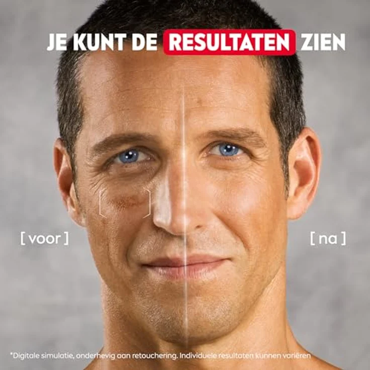 NIVEA MEN Luminous630, Gesichtsserum 2-in-1 Power Serum für Anti-Aging & Anti-Pickel, 30ml – Bild 7