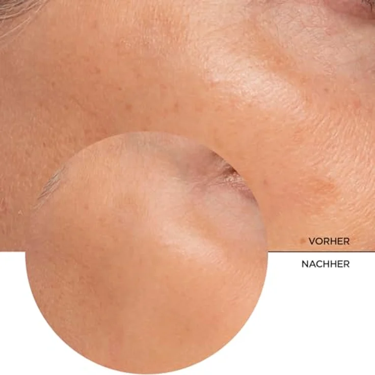 Revox Just Alpha Arbutin 2% + HA Gesichtsserum für strahlende Haut 30 ml – Bild 8