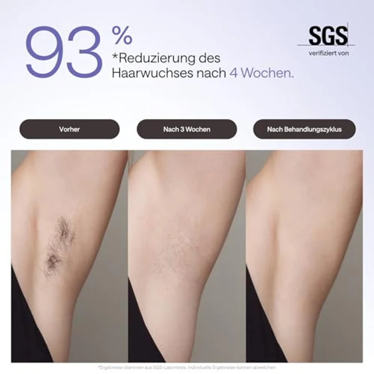 Ulike Air 3 Sapphire Ice Cooling, IPL-Haarentfernungsgerät in elegantem Violett für schmerzfreie Anwendung – Bild 3