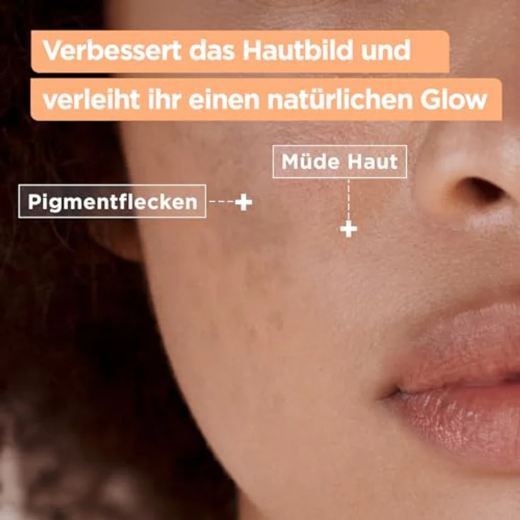 Mixa Anti-Müde Haut Comfort Cleanser, Beruhigend, Ebenmäßigere Haut, Mit Vitamin C und Squalan, Hypoallergen, 150 ml – Bild 3