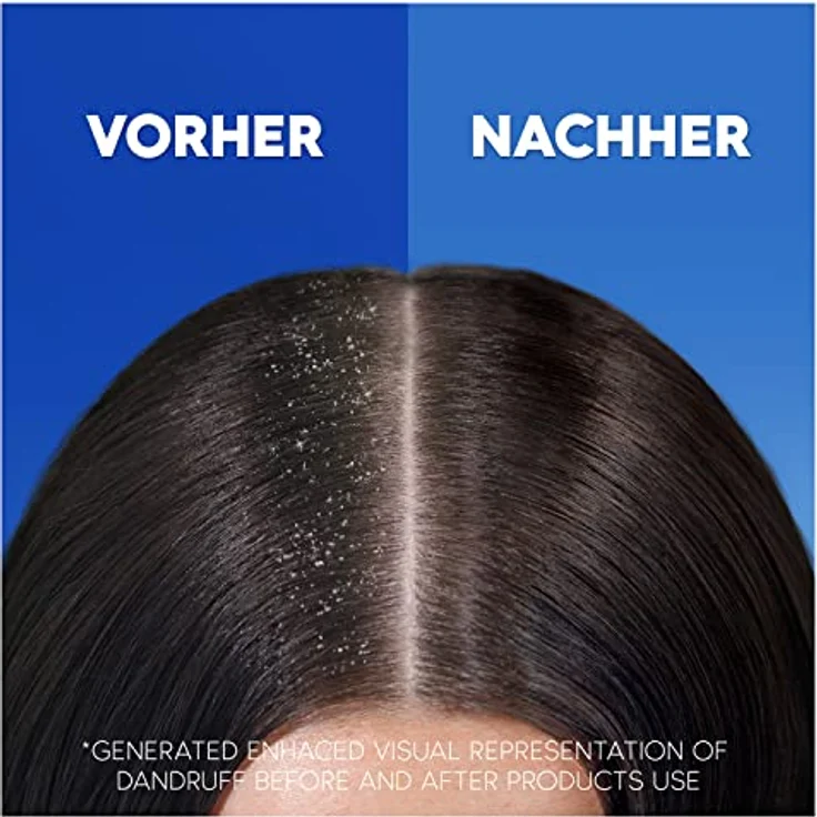 Head & Shoulders Empfindliche Kopfhaut Anti-Schuppen Shampoo, Bis Zu 100% Schuppenschutz, 300ml – Bild 3