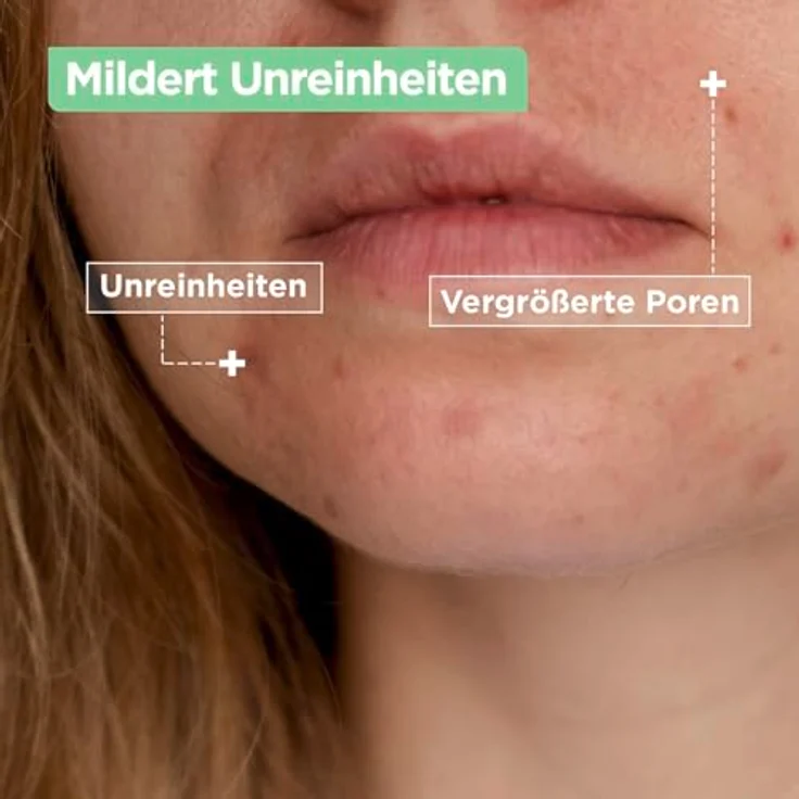 Mixa Anti-Unreinheiten Comfort Cleanser, Glättet das Erscheinungsbild der Poren, Mit Salicylsäure und Squalan, Geeignet für Gesicht & Hals, Hypoallergen, 150 ml – Bild 3