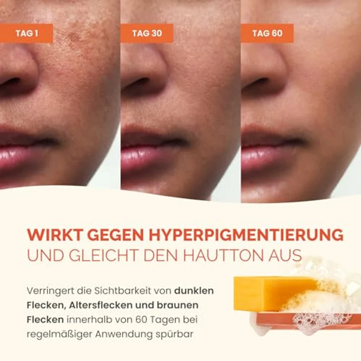 PLANTIFIQUE Kojic Acid Soap, 2 Stück - Kojisäure und Kurkuma Seife mit Hyaluronsäure, Kollagen und Vitamin C - Für Hyperpigmentierung und Dunkle Flecken, 160g – Bild 5