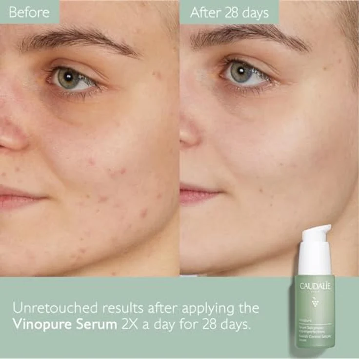 Caudalie Vinopure Skin Perfecting Serum Gesichtsserum 30 ml – Bild 8