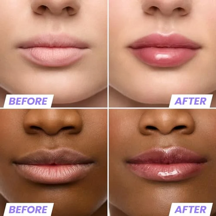 Wonderskin Lip Rehab Serum Oil, feuchtigkeitsspendendes, pflegendes, nicht klebriges Lippenöl mit tiefroter Tönung für trockene Lippen (Honey) – Bild 3