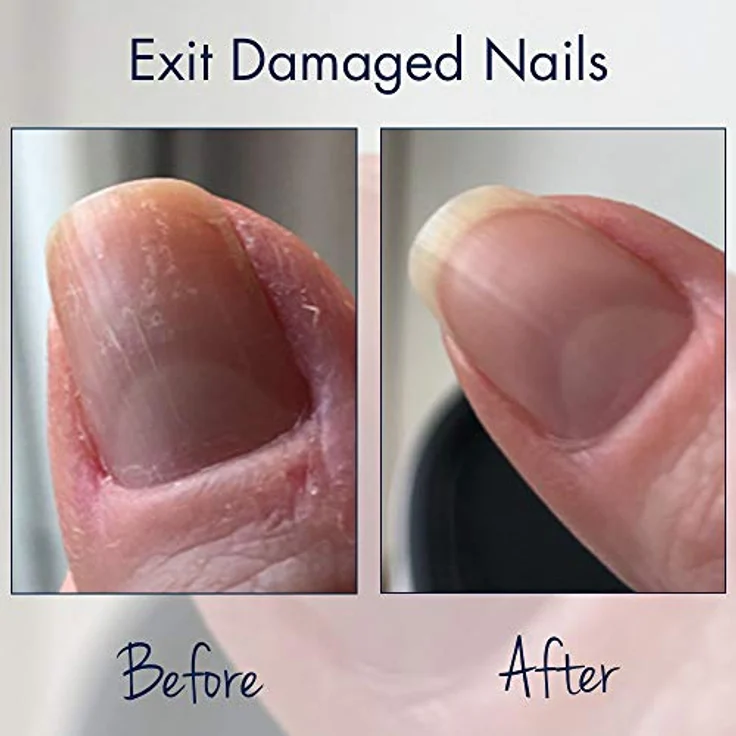 Herome Ende Extrem Beschädigte Nägelol Mandelöl - Repariert Extrem Beschädigte und Eingerissener Naturnägel nach dem Gebrauch von Kunstnägeln – besonders Gut mit Nagelhärter - 7ml. – Bild 3