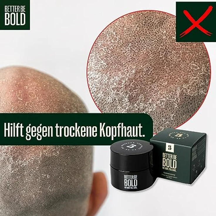 BETTER BE BOLD Kopfhautpflege No Hair. Full Care. Glatzencreme 50 ml – Bild 6