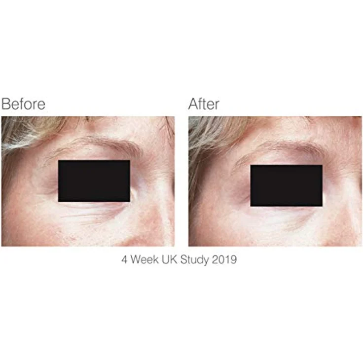 RIO Facelite Evolution, LED-Gesichtsmasken-Massagegerät zur Verbesserung der Hautbeschaffenheit und Festigung der Gesichts-konturen, 1 St. – Bild 6