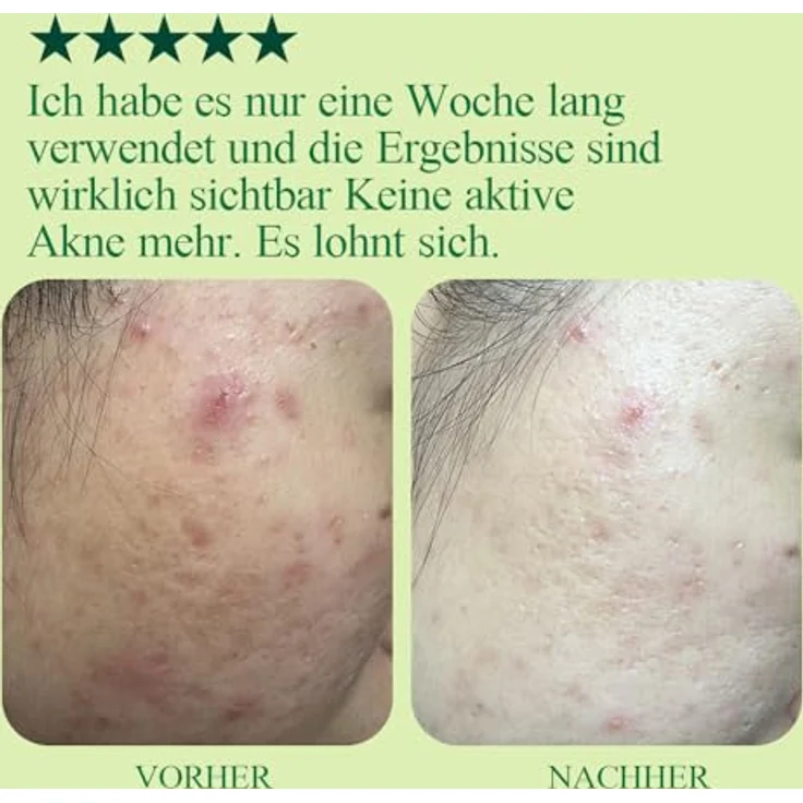 Pyunkang Yul Ultimate Calming Solution Cream, 30ml - Beruhigende Gesichtscreme für sensible Haut, vegan & frei von Duftstoffen – Bild 4