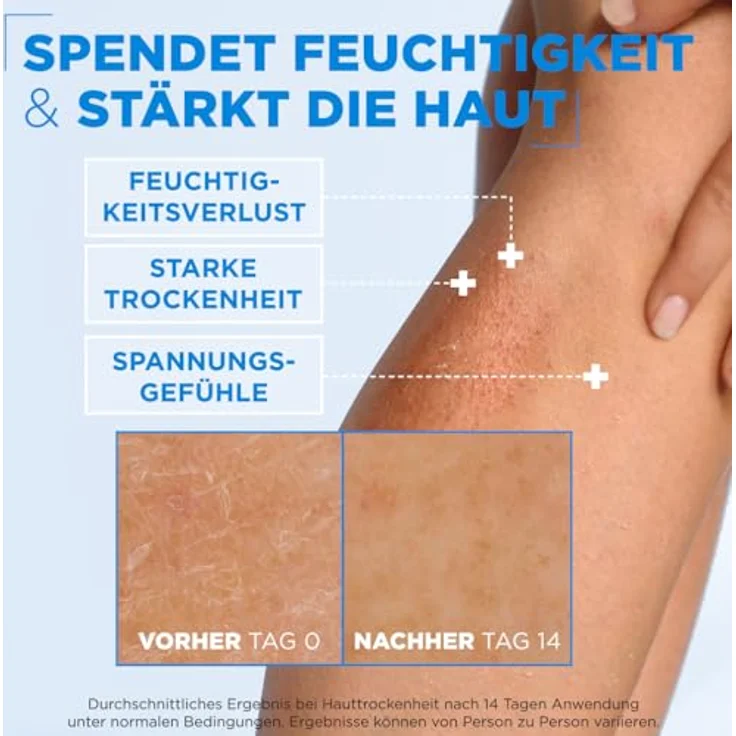 Mixa Ceramide Protect hautstärkende Creme, Feuchtigkeitsspendend, für sehr trockene & beanspruchte Haut, 400 ml – Bild 3