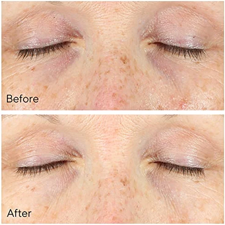 MURAD Serum & Treatments MURAD Serum & Treatments Vita-C Eyes Dark Circle Augenserum 15 ml – Bild 5