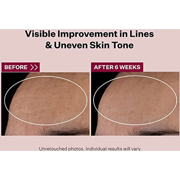 StriVectin Advanced Nächtliches Retinol-Multikorrekturserum (30ml) | Kämpft gegen Zeichen von Hautalterung, Verbessert das Aussehen von feine Linien, Falten, Hautton und Textur – Bild 3
