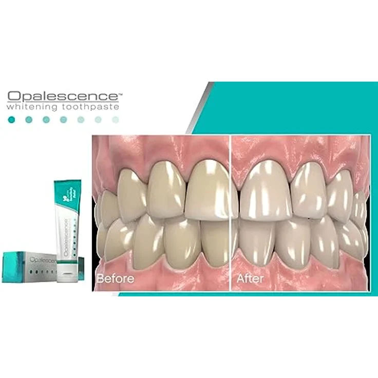 Opalescence Sensitivity Relief Whitening Toothpaste Whitening Zahnpasta für empfindliche Zähne 100 ml Unisex – Bild 2