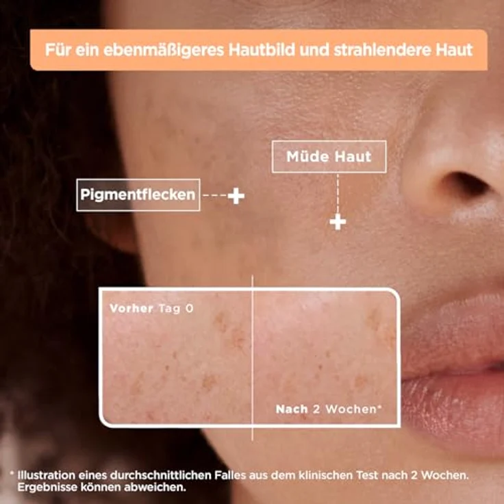 Mixa Anti-Pigmentflecken Serum, Für ungleichmäßige, fahle und sensible Haut mit Vitamin C und Niacinamid, LSF 20, Hypoallergen, 30 ml – Bild 3