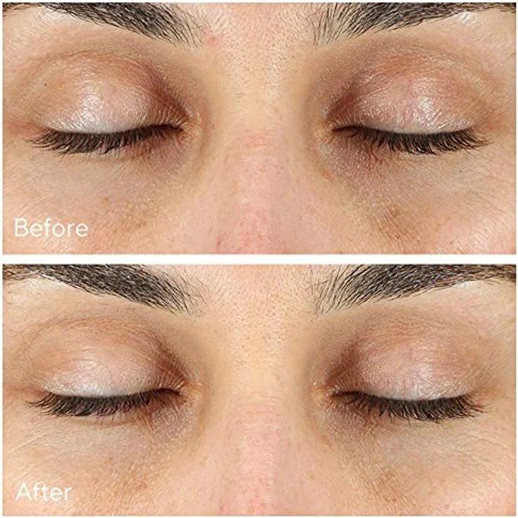 MURAD Serum & Treatments MURAD Serum & Treatments Vita-C Eyes Dark Circle Augenserum 15 ml – Bild 4
