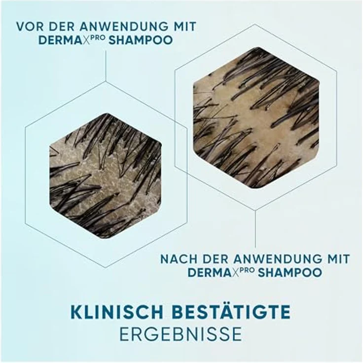 Head & Shoulders DermaXPro Pflegende Feuchtigkeit Anti-Schuppen-Shampoo 400ml mit Kokosöl und Ceramide-Komplex; 72H Feuchtigkeit für Trockene Kopfhaut, Marke - Head & Shoulders – Bild 4
