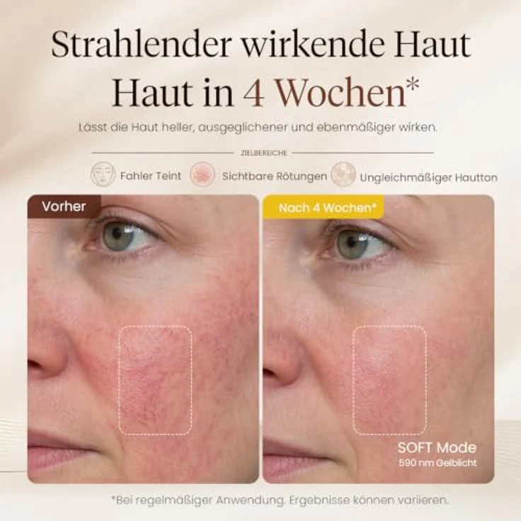 BOB AND BRAD PhysioFace LED Gesichtsmaske mit Rotlicht & Nahinfrarot, 4 Wellenlängen, 3 Modi, 10-Min.-Anwendung, Silikon-Augenpolster & verstellbares Kopfband, 480 LEDs für Hautpflege – Bild 5